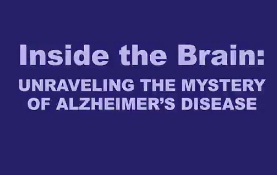 Πώς το Αλτσχάιμερ, καταστρέφει ανελέητα τον εγκέφαλο